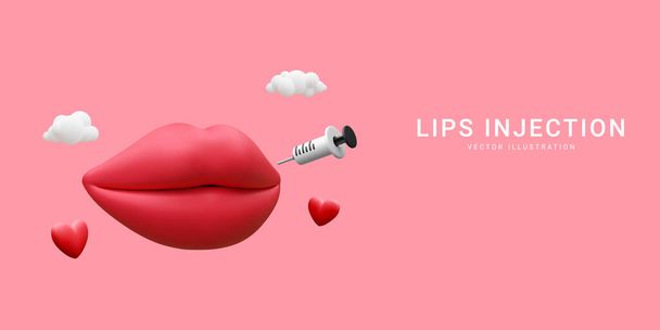 唇の注射のための3D現実的なバナー。皮膚科と美容治療の概念.赤い美的美しい唇で医療用プラスチック注射器で漫画スタイルで化粧品注射. - ベクター画像