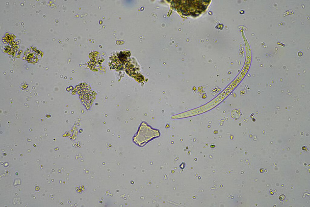 μικροοργανισμοί και βιολογία του εδάφους, με νηματώδεις και μύκητες στο μικροσκόπιο. σε δείγμα εδάφους και κομποστοποίησης στην Αυστραλία - Φωτογραφία, εικόνα