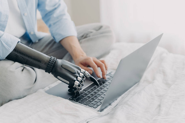 Bionic prosthesis and healthy arm. Hands of disabled girl are typing on keyboard of laptop. Handicapped european woman with artificial limb working on pc at home. Bionic fingers on buttons. - Zdjęcie, obraz