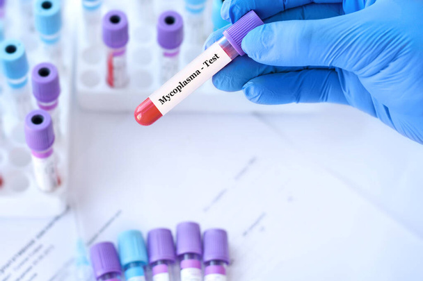 Doctor holding a test blood sample tube with Mycoplasma test on the background of medical test tubes with analyzes. - Zdjęcie, obraz