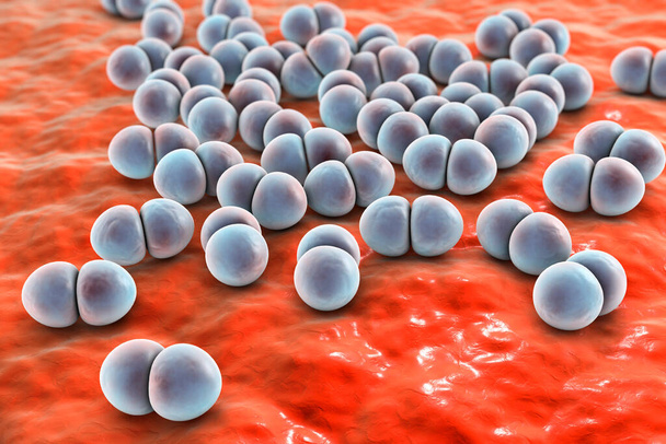 Bacterias neumococos, Streptococcus pneumoniae, bacterias esféricas grampositivas, diplococos que causan neumonía, ilustración 3D - Foto, imagen