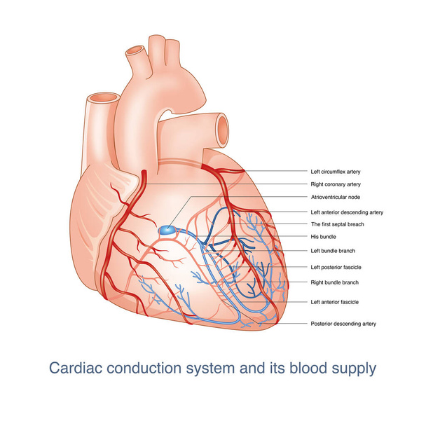 El sistema de conducción del corazón es suministrado por las ramas de la arteria coronaria. Una vez que los vasos sanguíneos están bloqueados, puede causar trastorno de conducción. Esta imagen es adecuada para fondo oscuro. Esta imagen es adecuada para fondo claro. - Foto, imagen
