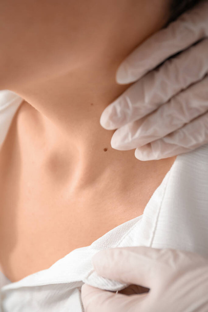 Dermatologist examining mole on young woman's neck in clinic, closeup - Foto, immagini