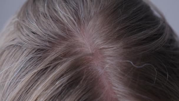 Detailní záběr mladé ženy s šedými vlasy. Rané šedé vlasy. Problémy s vlasy. - Záběry, video