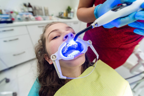 Diş hekimi kıza diş teli takarken ultraviyole lamba kullanıyor..  - Fotoğraf, Görsel