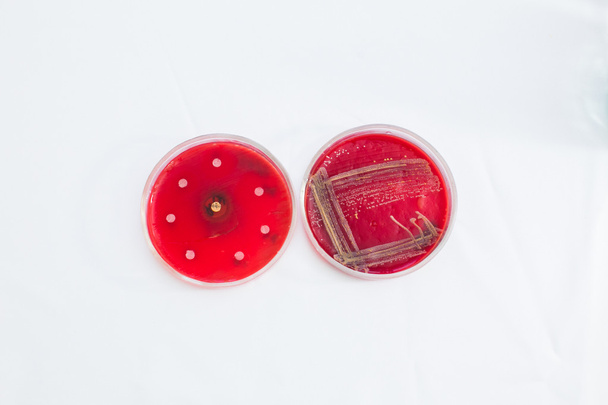 Petri dishes with growing bacteria - Foto, Imagem