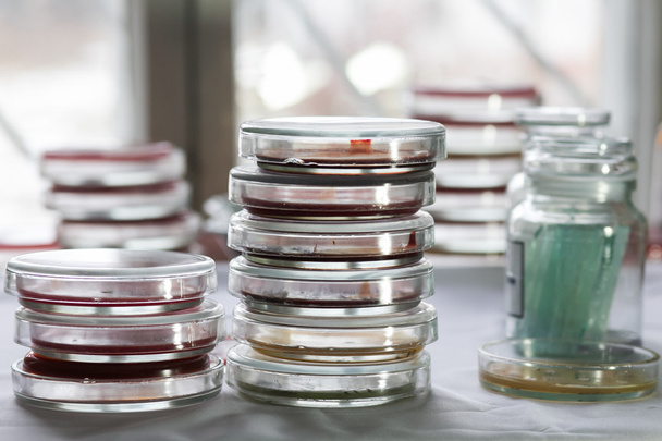 Petriho misky v laboratoři - Fotografie, Obrázek