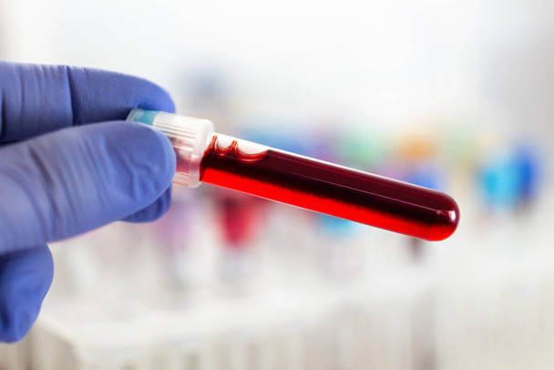 Τεχνικός με σωλήνα εξέτασης αίματος για ανάλυση στο ερευνητικό εργαστήριο. Ερευνητής κρατώντας σωλήνα δείγματος αίματος για νέα διάγνωση Variant covid-19 στο εργαστήριο - Φωτογραφία, εικόνα