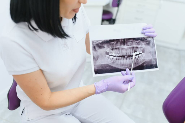 Dentist explaining the details of a x-ray teeth picture to his patient in clinic. Oral care, orthodontics - Fotoğraf, Görsel