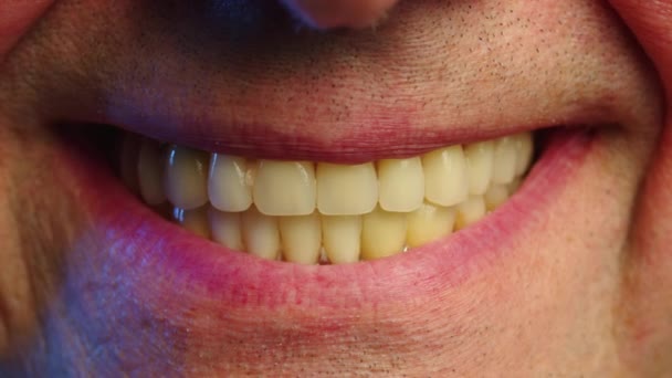 Close-up glimlach van een oudere man met kunstmatige tanden. Periodontale ziekte en ontbrekende tanden bij een oudere man. Close-up shot van een tandeloze mannelijke mond. Hoge kwaliteit 4k beeldmateriaal - Video