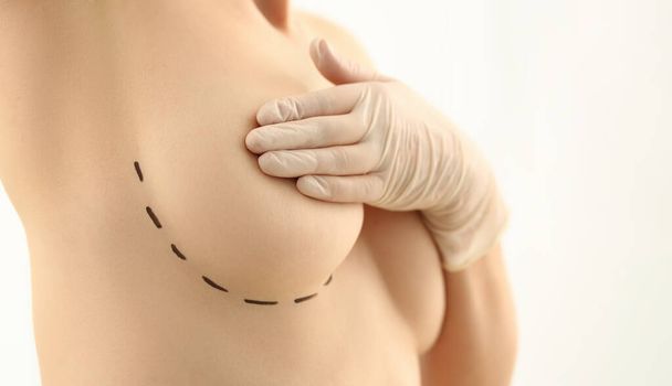 Beautiful woman covering breasts with black surgical lines. Plastic surgery and breast augmentation and lift - Photo, Image