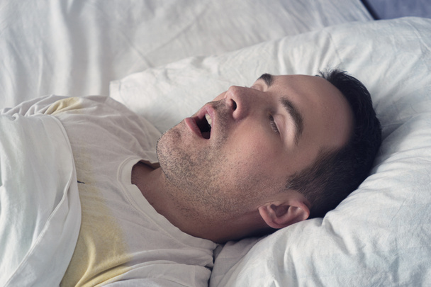 Portré egy férfiról, aki nyitott szájjal alszik. A horkolás problémája alvás közben. Egy fiatal, aranyos srác egy fehér ágyon alszik nappal vagy reggel. - Fotó, kép