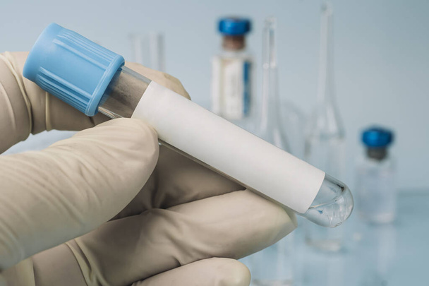 Reagenzglas mit leerem Etikett zur biologischen Probe für die medizinische Laborforschung auf blauem Hintergrund. transparente Flüssigkeit in einem Glasrohr in der Hand einer Laborantin. DNA-Test. Labortests - Foto, Bild