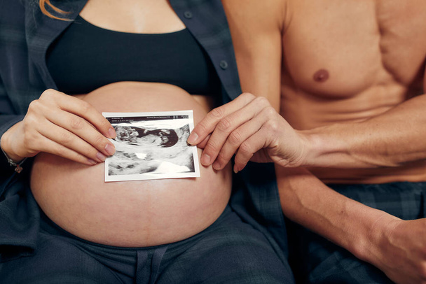 Casal grávida a fazer ecografia. Conceito de Assistência à Saúde na Gravidez
 - Foto, Imagem