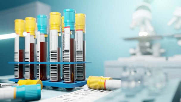 Rows of blood samples in a laboratory being screened and tested for medical use. 3D illustration - Foto, afbeelding