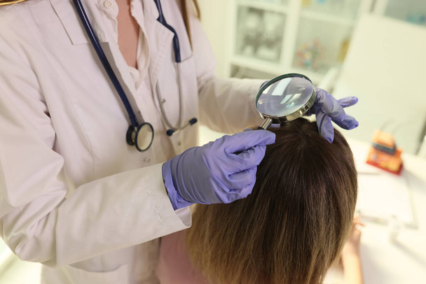 Trichologist descobre a causa da perda de cabelo do paciente feminino. Especialista em luvas de casaco e borracha olha para o couro cabeludo através de lupa - Foto, Imagem