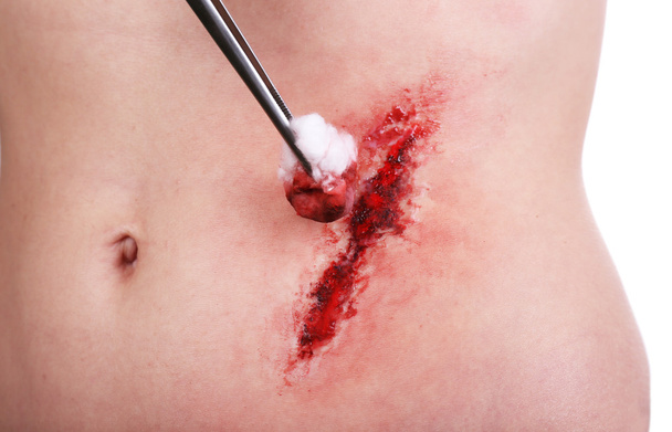 Injured abdomen with blood isolated on white - Photo, image
