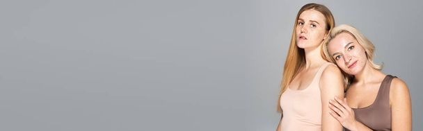 Uśmiechnięta kobieta z trądzikiem stojąca w pobliżu przyjaciela z piegami wyizolowanymi na szarym, sztandarze  - Zdjęcie, obraz