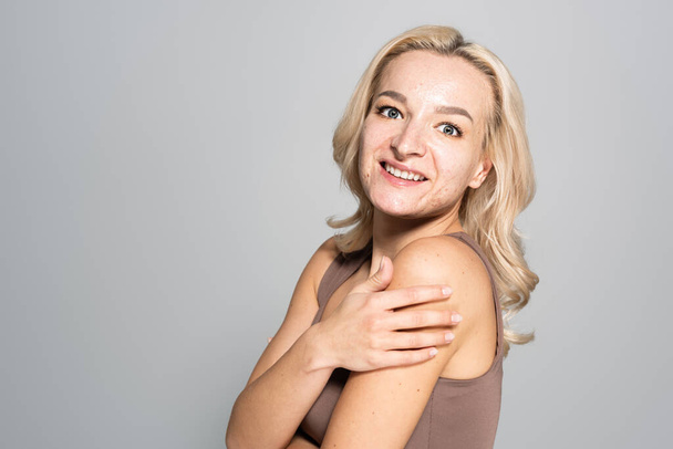 Carefree woman with acne on skin touching shoulder isolated on grey  - Фото, зображення