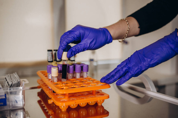 Hand eines Labortechnikers mit Blutröhrchen-Test und Hintergrund eines Regals mit Blutproben anderer Patienten Labortechniker mit Blutröhrchen-Test. - Foto, Bild