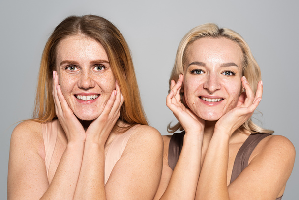 Pozitív barátok problémás bőr megható arc elszigetelt szürke  - Fotó, kép