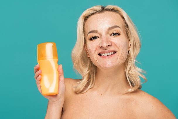 mujer alegre con botella de retención de acné con protector solar aislado en turquesa - Foto, imagen