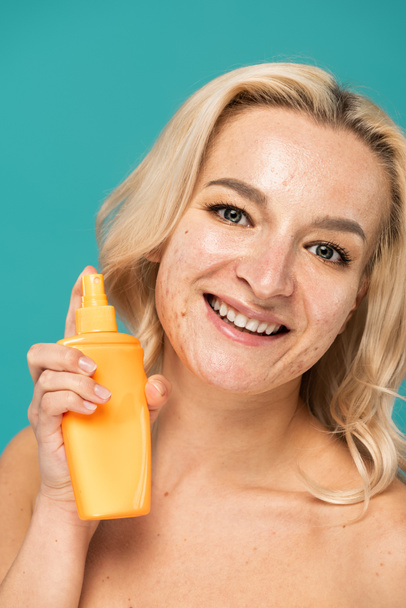 happy woman with adult acne holding bottle with sunscreen isolated on turquoise - Zdjęcie, obraz