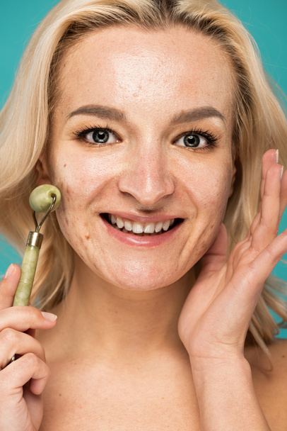 close up of cheerful blonde woman with acne holding jade roller isolated on turquoise - Фото, изображение