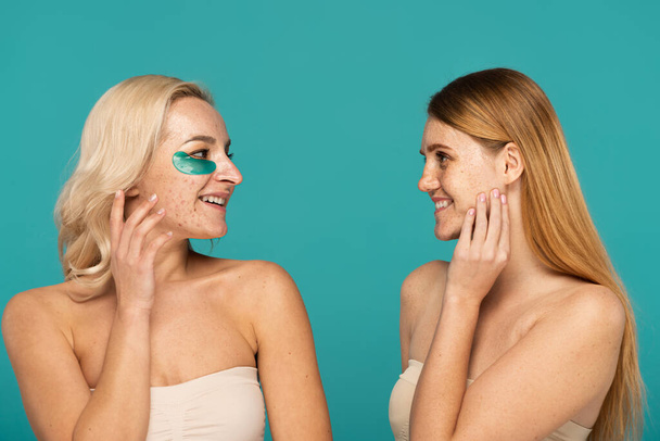 blond vrouw met acne en oog vlekken glimlachen terwijl het kijken naar sproeten vriend geïsoleerd op turquoise  - Foto, afbeelding