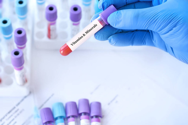 Doktor drží zkumavku se vzorkem krve s vitamíny a minerály test na pozadí lékařských zkumavek s analýzami - Fotografie, Obrázek