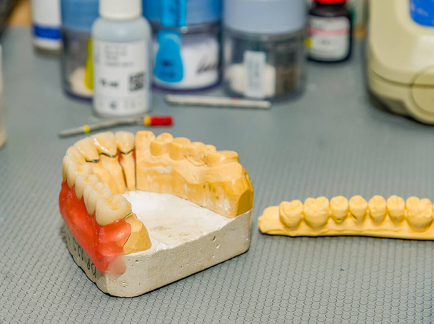 Bir diş teknisyeninin ofisinde çenenin alçı kalıbı - Fotoğraf, Görsel