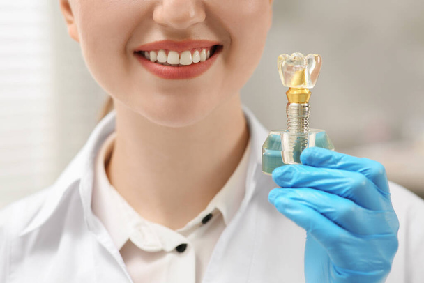 Dentist holding educational model of dental implant indoors, closeup - Fotoğraf, Görsel