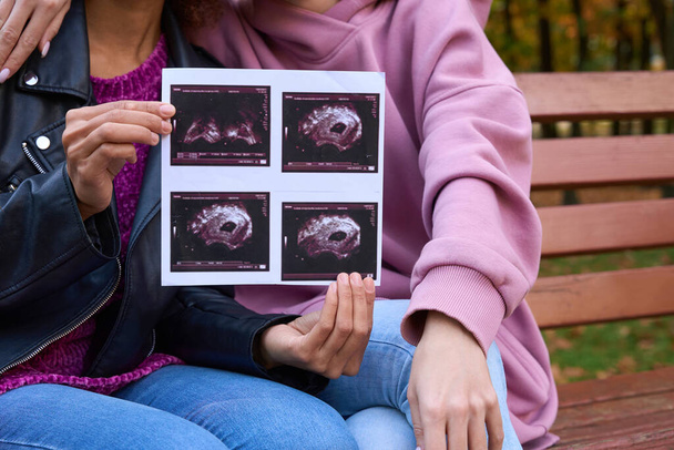 Foto recortada de la señora sentada en el banco junto a su compañera femenina con fotos de ultrasonido del bebé nonato en las manos - Foto, imagen