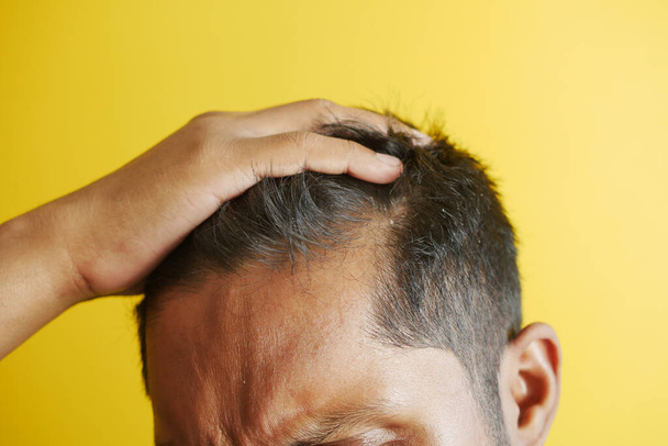 hair loss concept with man checking his hair . - Foto, Imagem