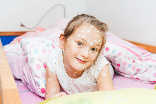 Little girl of 7 years old with chicken pox resting in a bed - Photo, Image