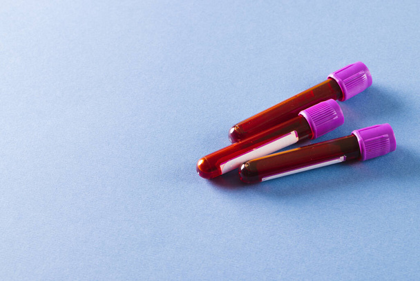 Three blood sample tubes with purple lids, on blue background with copy space. Blood health diagnostics, analysis and blood donation. - Φωτογραφία, εικόνα