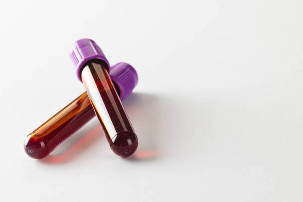 Two blood sample tubes with purple lids, on white background with copy space. Blood health diagnostics, analysis and blood donation. - Foto, afbeelding