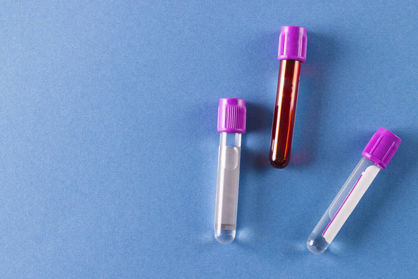 Three sample tubes with purple lids, one containing blood, on blue background with copy space. Blood health diagnostics, analysis and blood donation. - Foto, afbeelding