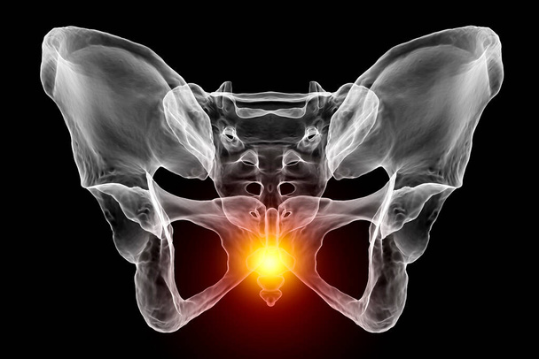 Una ilustración médica en 3D que resalta el hueso del coxis marcado en rojo, que representa el dolor del coxis que puede ocurrir debido a una lesión, parto o estar sentado prolongado. Vista frontal - Foto, imagen