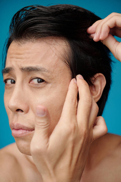 Face of worrying young man applying hair loss treatment - Φωτογραφία, εικόνα