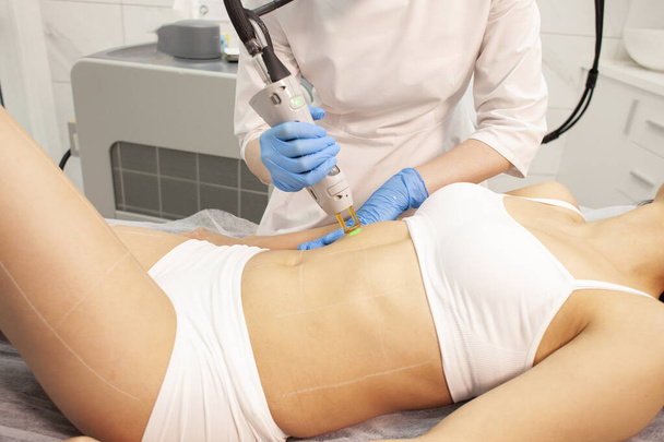 alexandrite laser hair removal procedure in cosmetology clinic, cosmetologist doctor in uniform makes depilation of the abdomen of girl patient with modern equipment - Photo, Image