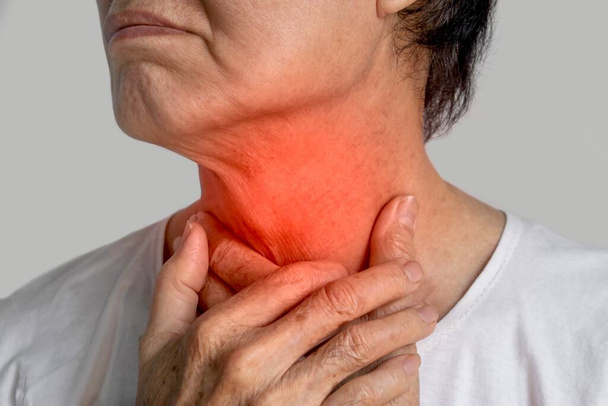 Vermelhidão no pescoço do homem asiático. Conceito de dor de garganta, faringite, laringite, esofagite, tireotoxicose, tireoidite, asfixia ou disfagia. - Foto, Imagem