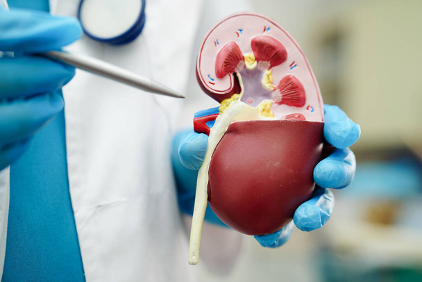 Chronic kidney disease, doctor holding model for treatment urinary system, urology, Estimated glomerular filtration rate eGFR. - Фото, изображение