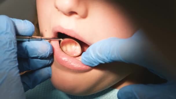 Посещение ребенка стоматологом, осмотр зубов, кариес молочных зубов. Лечение зубов у детей - Кадры, видео
