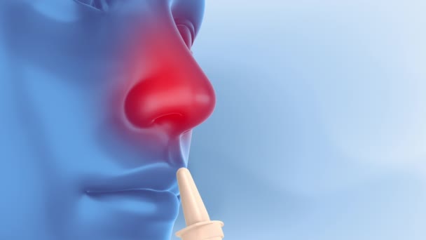 Erkältung mit abschwellendem Nasenspray beseitigen - Filmmaterial, Video