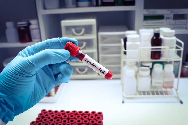 teste de ferritina para procurar anormalidades do sangue, amostra de sangue para analisar no laboratório, sangue em tubo de teste - Foto, Imagem