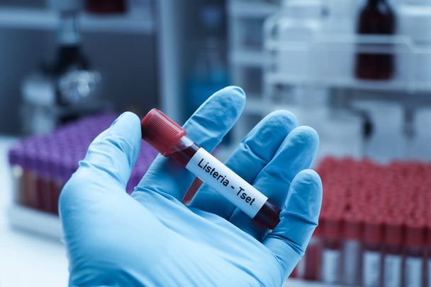 Test de Listeria pour rechercher des anomalies du sang, échantillon de sang à analyser en laboratoire, sang dans une éprouvette - Photo, image
