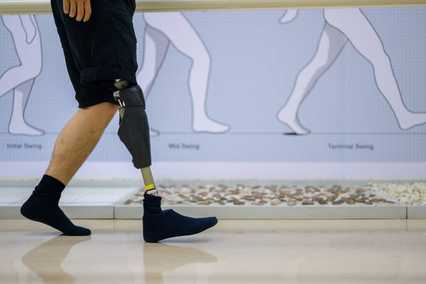 Athlete man with prosthetic leg walking at health care center, People with high tech technology at prosthetic manufacturing, New artificial limb production for disabled people - Photo, Image