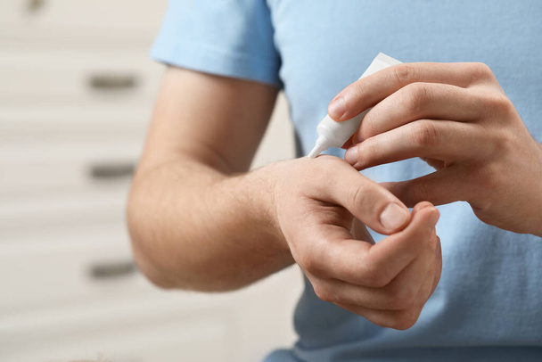 Man applying ointment from tube onto his wrist indoors, closeup - Фото, зображення