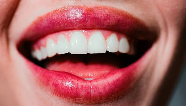 Smile teeth. Laughing woman mouth with great teeth close up. Healthy white teeth. Closeup of smile with white healthy teeth - Fotó, kép